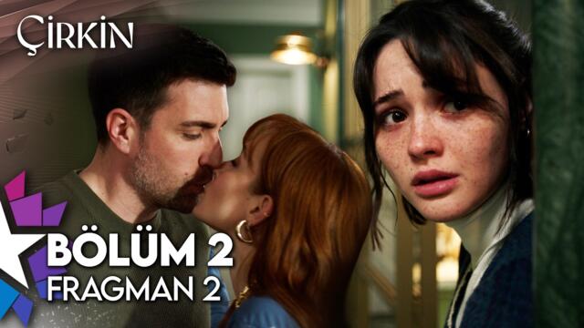 Çirkin 2. Bölüm 2. Fragman | "Beni Öyle Sevsin Diye Ömrümü Verirdim!"