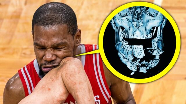 Most BRUTAL Fouls in NBA History..