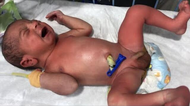 Cute Baby Diaper Changing & Gentle Care in NICU 💞 | Heart-Touching Moments #NICUBaby #BabyCare