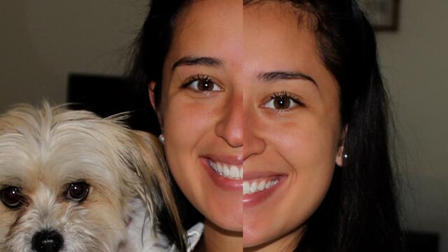 Texas Nurse Becomes The Patient After Having A Stroke At 24