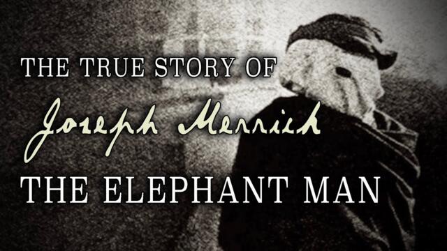 "The True Story of Joseph Merrick: 'The Elephant Man'" (1997)