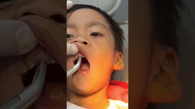 My brave patient