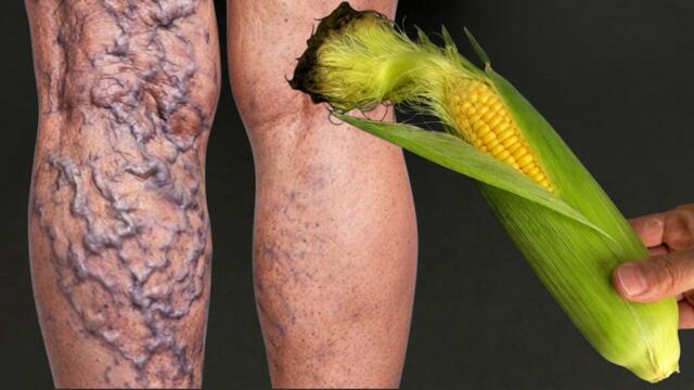 Eine Pflanze, die alles heilt❗️Ödeme, Krampfadern, Arthritis, Rheuma, Nieren, Leber