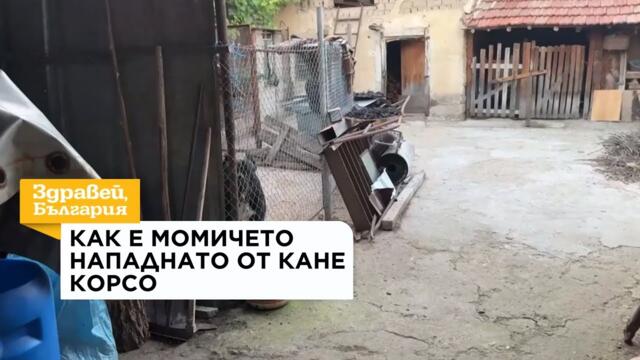 Какво е състоянието на момичето, нападнато от Кане Корсо | 04 авг. 2026