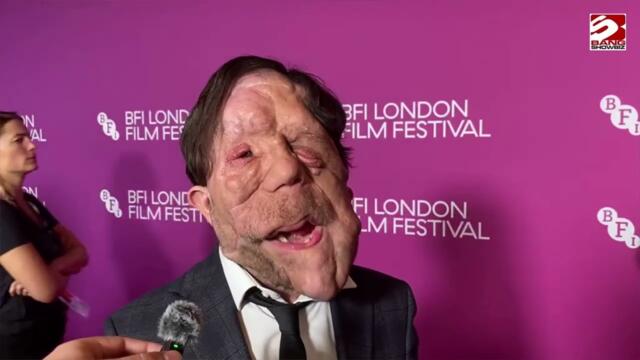 Adam Pearson reveals he would 'love to work with Adam Sandler'