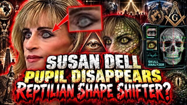 Does Susan Dell Eye Really Shape-Shift?