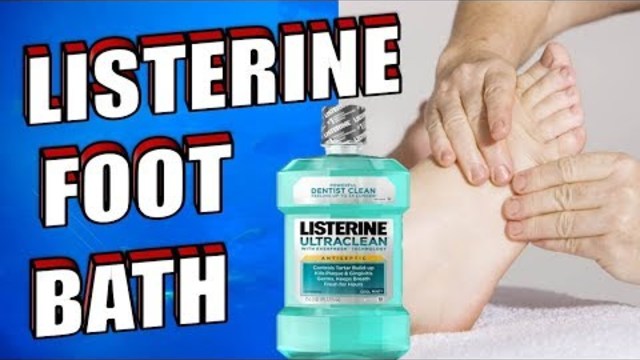 Listerine & Vinegar Foot Miracle Soak Recipe for Toenail Fungus, Dead Skin, Calluses & Cracked Heels