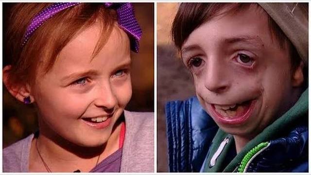 Lana i Patrik hrabrom akcijom ruše predrasude o bolesnoj djeci