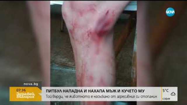 Питбул нападна и нахапа мъж и кучето му - Здравей, България (21.11.2018г.)