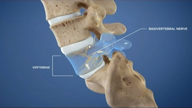 Лечение на болките в кръста