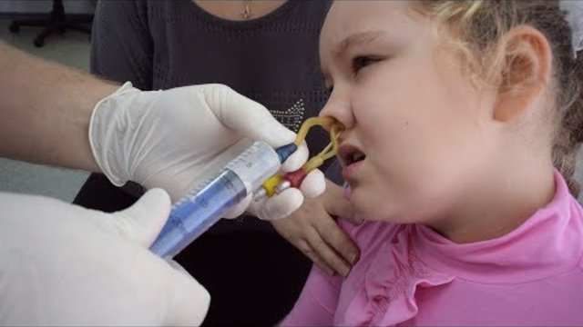 Лечение гайморита у детей без прокола. Как вылечить гайморит у ребенка быстро и без прокола?