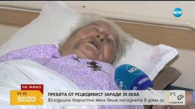 Зверски пребитата жена от Гурково разказва за ужаса от преживяното (22.01.2019г.)